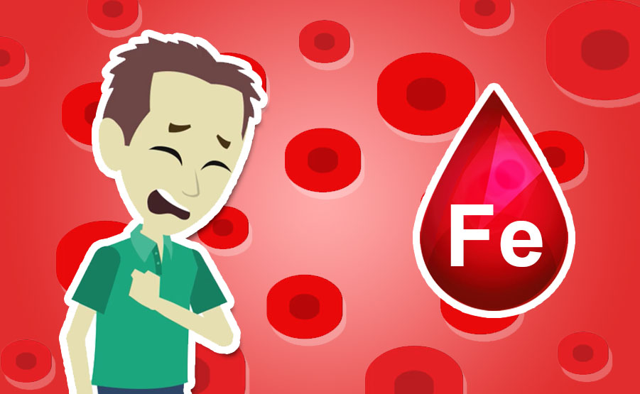 Anemia sideropenica o carenza di ferro