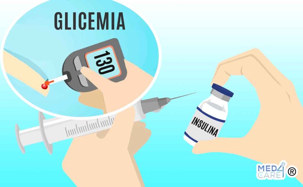 Diabete e scansione automatica della glicemia