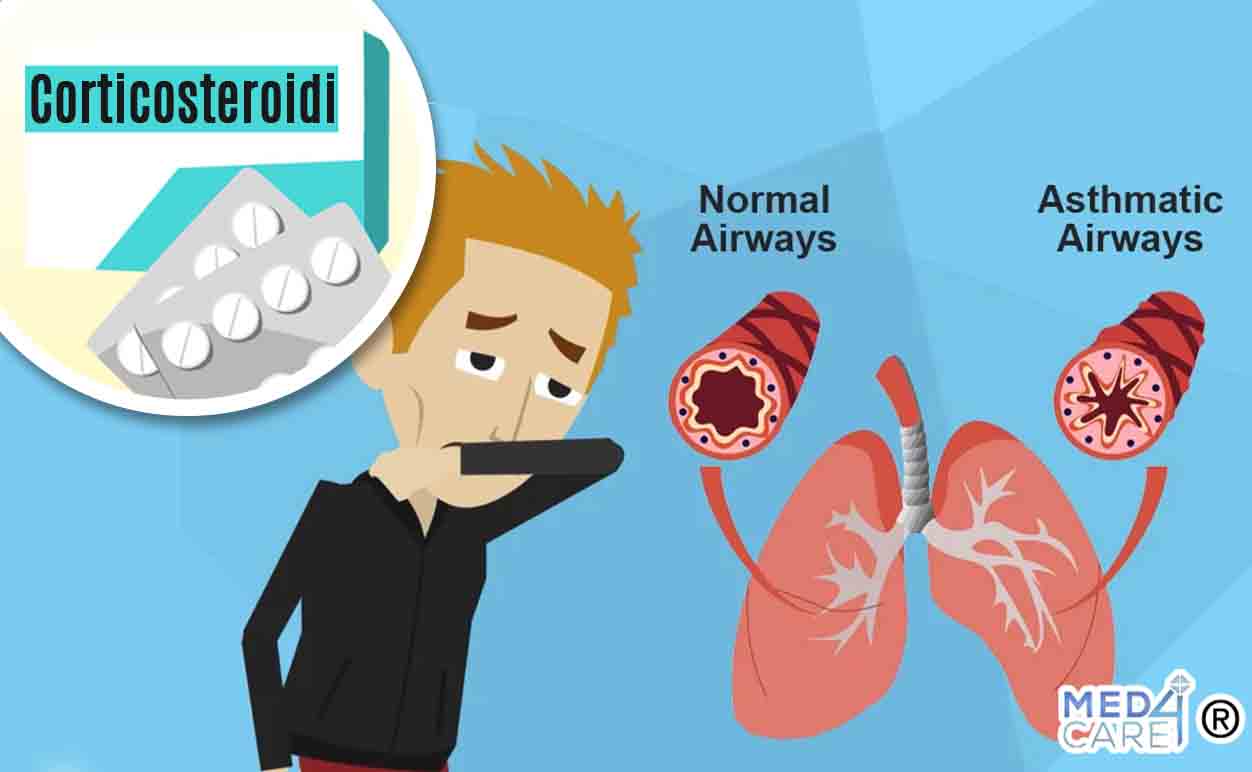 asma e corticosteroidi, asma bronchiale
