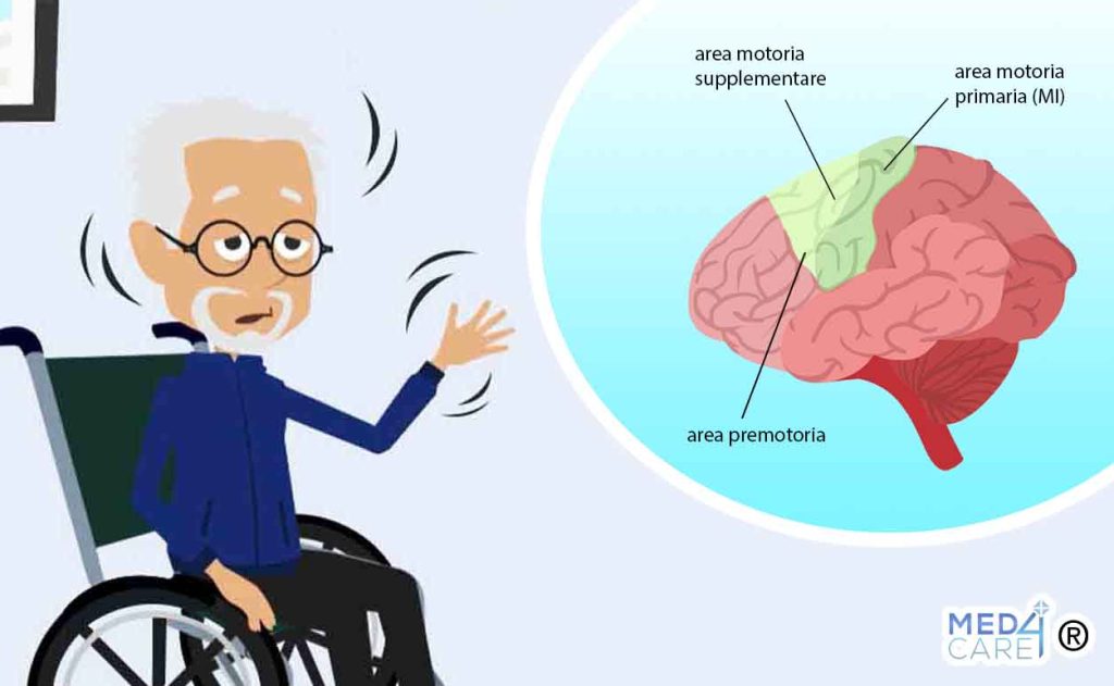 Parkinson e corteccia motoria, sostanza bianca, morbo di Parkinson