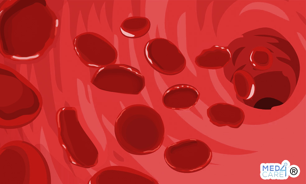 Anemia mediterranea, anemia, talassemia