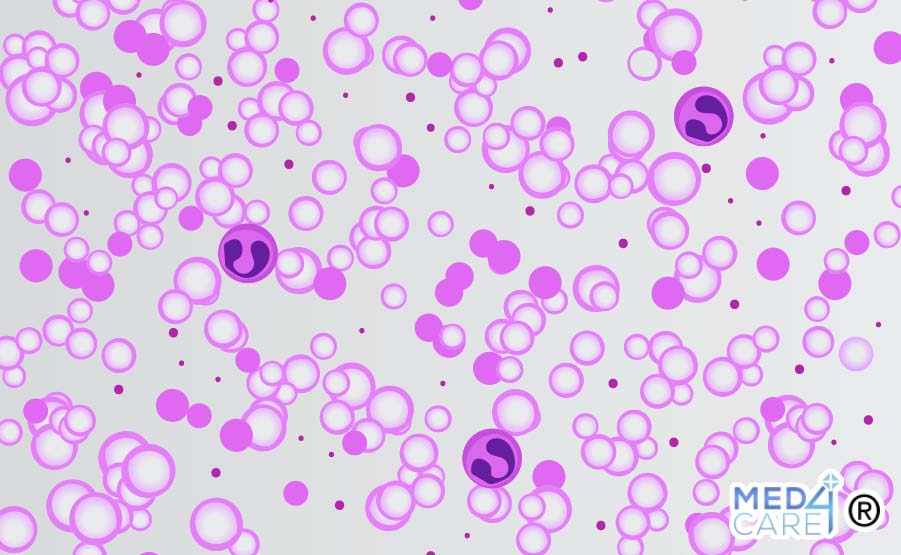 Eosinofili, globuli bianchi, eosinofilia