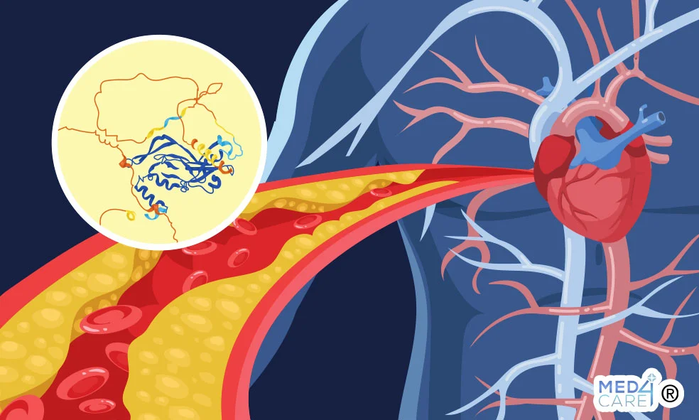 Tbx1 nel processo di guarigione di infarto del miocardio, infarto del miocardio, cura dell'infarto del miocardio