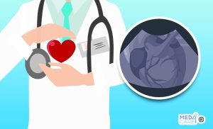 Amiloidosi cardiaca e funzione del cuore, amiloidosi cardiaca, cuore