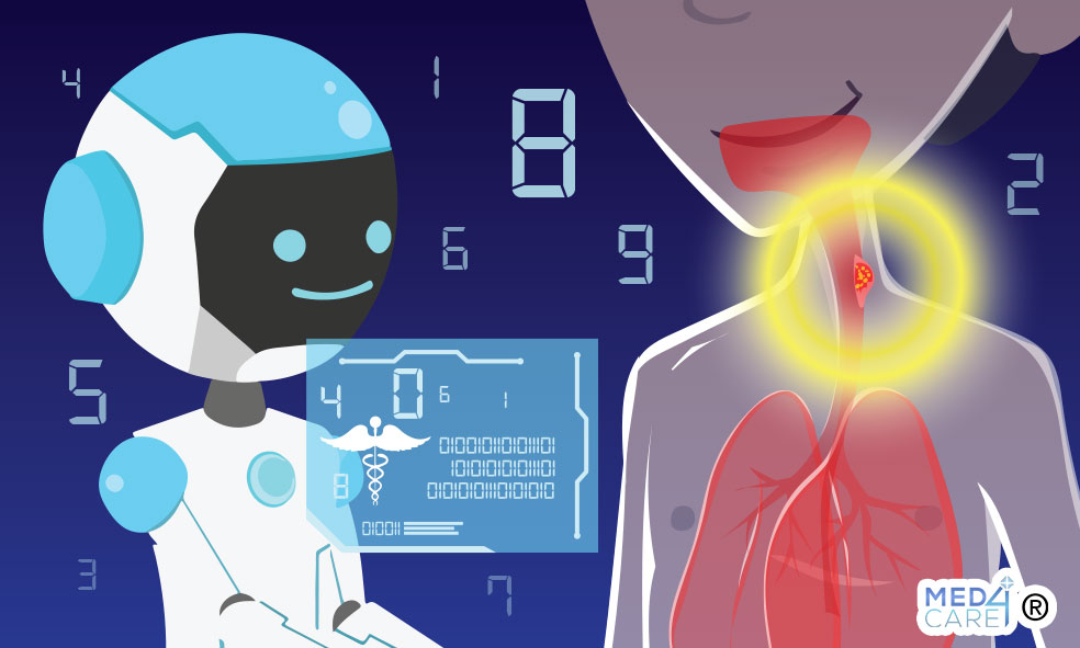 carcinoma esofago con endoscopia e intelligenza artificiale (AI), intelligenza artificiale, AI, carcinoma squamoso dell'esofago, esofago, cancro dell'esofago, tumore dell'esofago