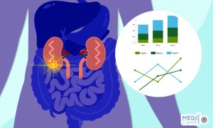 Scopri di più sull'articolo Incidenza dei tumori maligni genito-urinari: studio sulle disparità sociodemografiche alla base